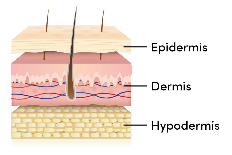 Kuva ihon kolmesta kerroksesta, epidermis, dermis ja hypodermis.